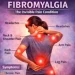 Fibromyalgia